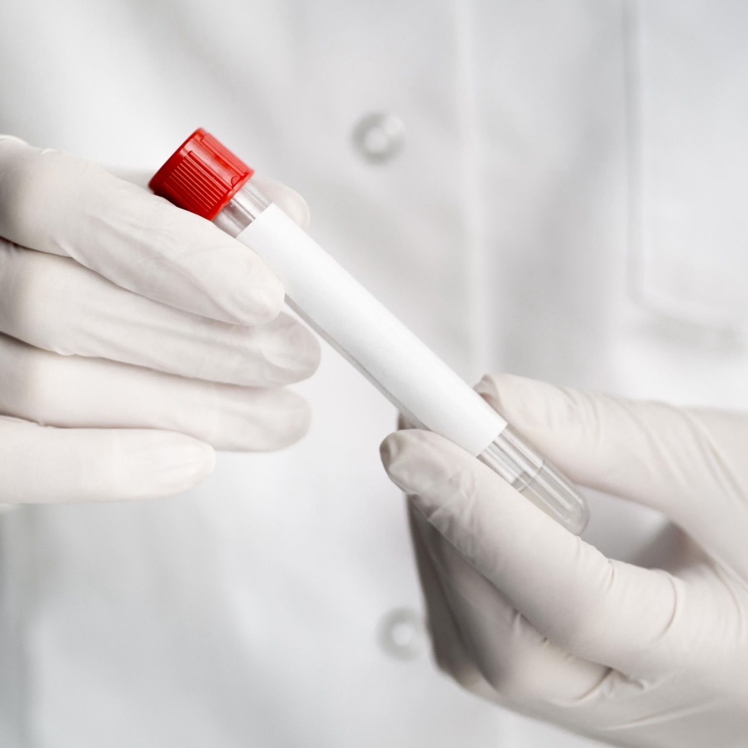 Dépistage Angine et Cystite, Test Covid, Pharmacie D'Abraham, Sens, Saint-Clément